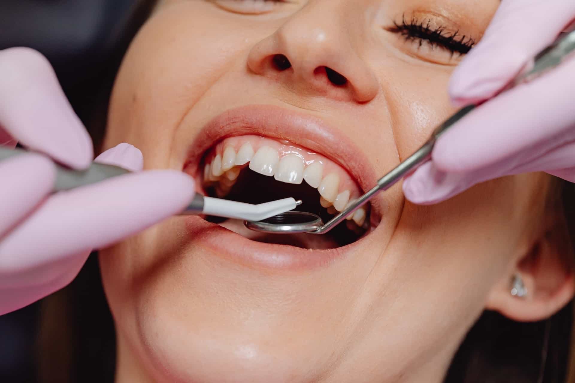 A woman smiling during a dental exam